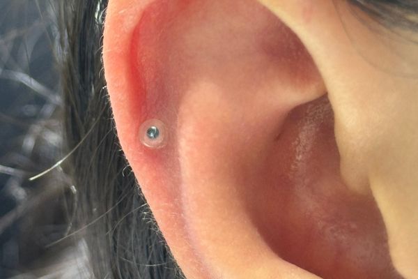 Cách giữ lỗ tai không bị bít 