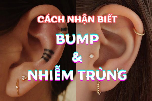 Cách nhận biết bump và nhiễm trùng