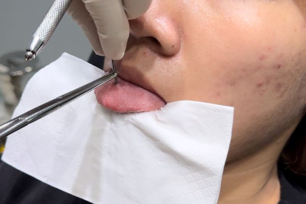 Cùng lúc xỏ khuyên lưỡi và môi có sao không?