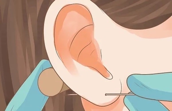 Dấu hiệu nhiễm trùng lỗ xỏ khuyên