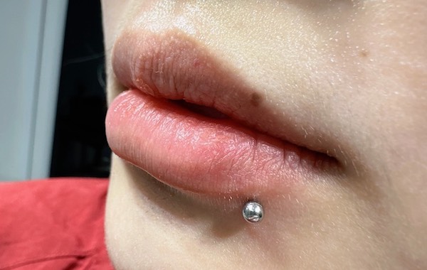 Đau răng xỏ khuyên môi được không