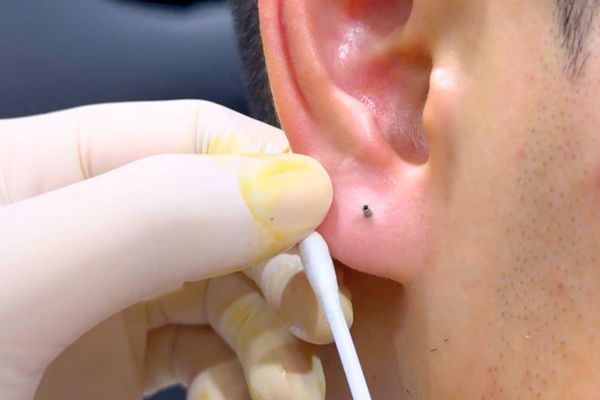 Dịch vụ thay khuyên TinyBox: Miễn phí, an toàn, chuẩn gu