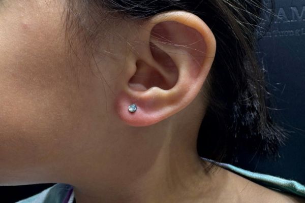 ảnh bé ok365 đăng nhập tai trong mùa hè đáng yêu nhất 8/2024