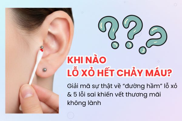 Khi nào lỗ xỏ hết chảy máu? Sự thật về "đường hầm" lỗ xỏ