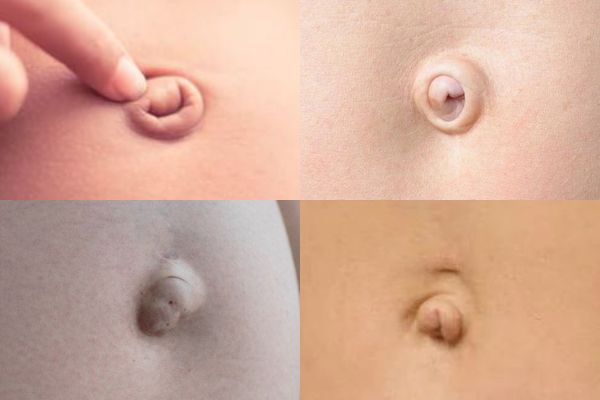 Lỗ rốn như thế nào thì nên xỏ và không nên xỏ?