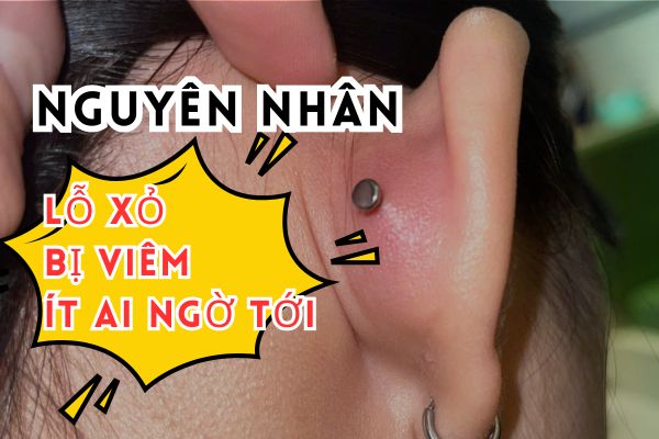 Lỗ xỏ bị viêm: Nguyên nhân ít ai ngờ & giải pháp từ Tinybox