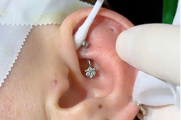 Lỗ xỏ bị viêm: Nguyên nhân ít ai ngờ & giải pháp từ Tinybox