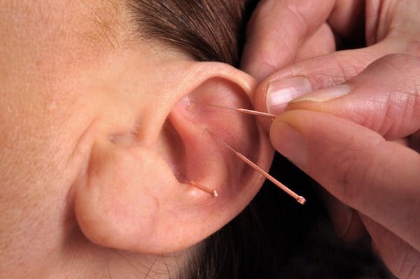 Lỗ xỏ Daith có thực sự giúp bạn giảm đau đầu?