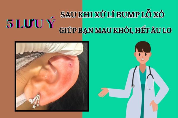 xử lí bump tại TinyBox