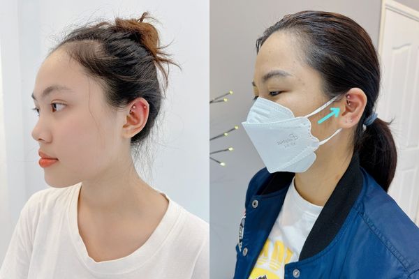 Mức độ đau các vị trí xỏ khuyên tai