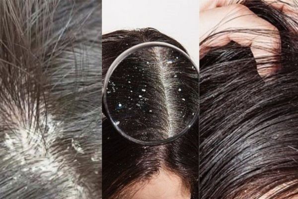 Nếu bạn không muốn lỗ xỏ toang, stop ngay 4 thói quen này