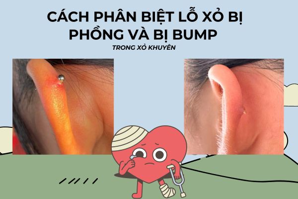 Cách phân biệt lỗ xỏ bị phồng và bị bump trong xỏ khuyên