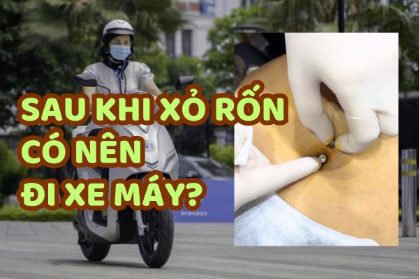 Sau khi xỏ khuyên rốn có đi được xe máy không?