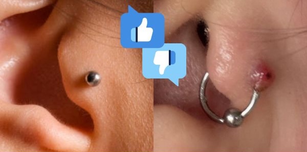 Tại sao lỗ xỏ chưa lành đeo khuyên tròn dễ bị sẹo lồi?
