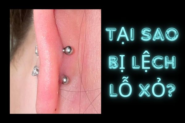 Tại sao lỗ xỏ khuyên bị lệch