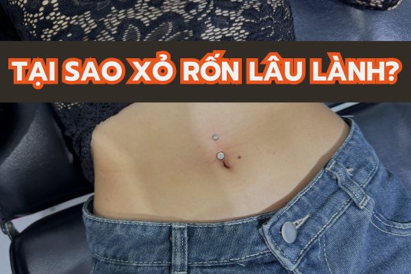 Tại sao lỗ xỏ khuyên rốn lâu lành? 