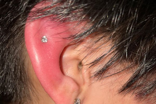 Tại sao xỏ khuyên dùng chất liệu tốt mà vẫn bị nhiễm trùng? 