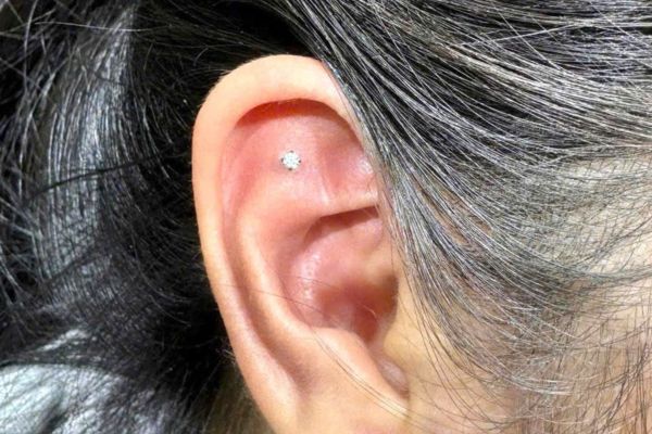 Thay khuyên sớm có sao không? Khi nào cần thay khuyên sớm?