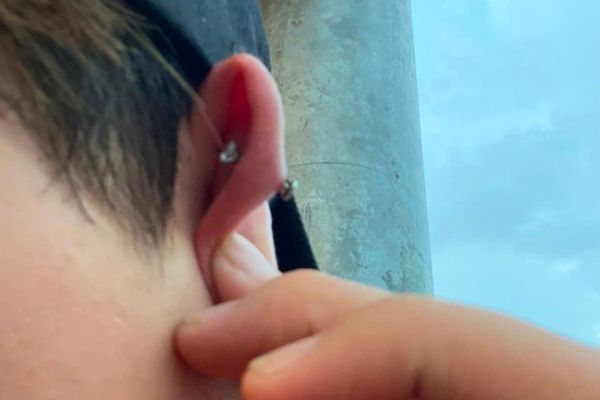 Thói quen bẻ tai sau khi ok365 đăng nhập & 3 hậu quả khôn lường