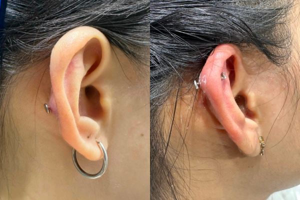 Thói quen bẻ tai sau khi ok365 đăng nhập & 3 hậu quả khôn lường