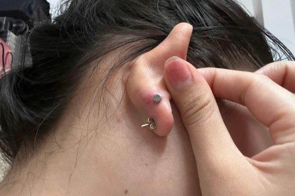 Thói quen bẻ tai sau khi ok365 đăng nhập & 3 hậu quả khôn lường