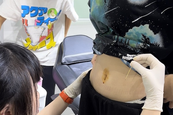 Tiêm HPV ở VNVC có xỏ khuyên được không