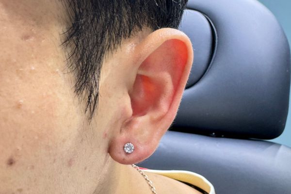 Tổng hợp hình ảnh xỏ Lobe cho các bạn nam tại TinyBox 6/2024