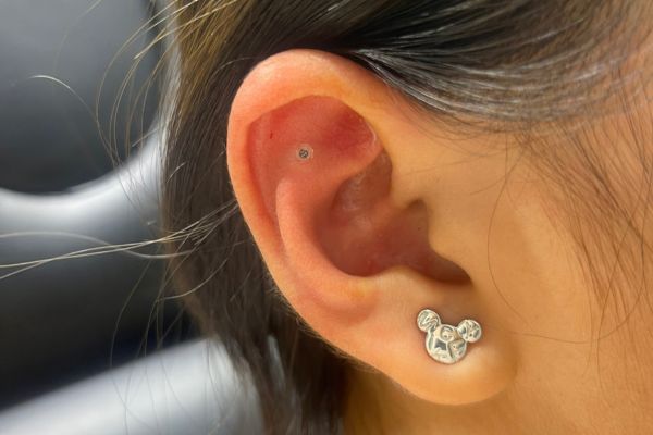 Top 5 vị trí sụn hot được bạn nữ lựa chọn