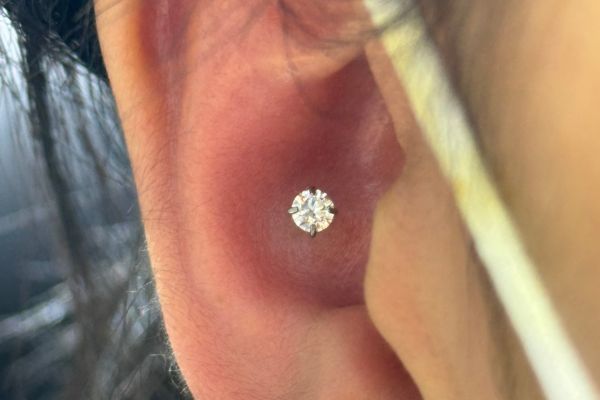 Top 5 vị trí sụn hot được bạn nữ lựa chọn