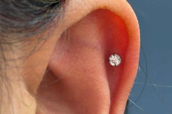 Top 5 vị trí sụn hot được bạn nữ lựa chọn