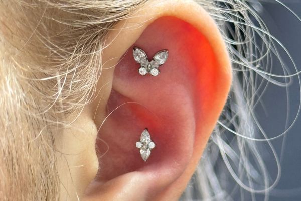 Top 5 vị trí sụn hot được bạn nữ lựa chọn