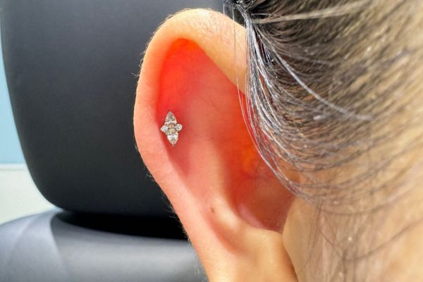 Top 5 vị trí sụn hot được bạn nữ lựa chọn