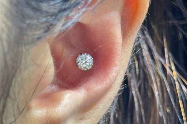 Top 5 vị trí sụn hot được bạn nữ lựa chọn