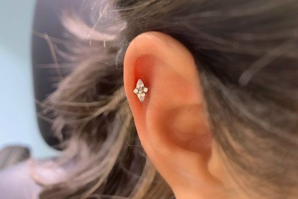 Top 5 vị trí sụn hot được bạn nữ lựa chọn