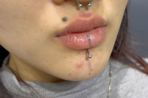 Vệ sinh lỗ xỏ môi như thế nào cho đúng cách?