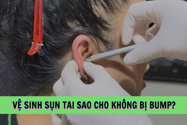 Vệ sinh lỗ xỏ sụn sao cho an toàn