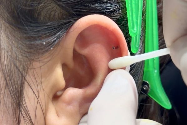 Vệ sinh lỗ xỏ sụn sao cho an toàn, không bị bump?