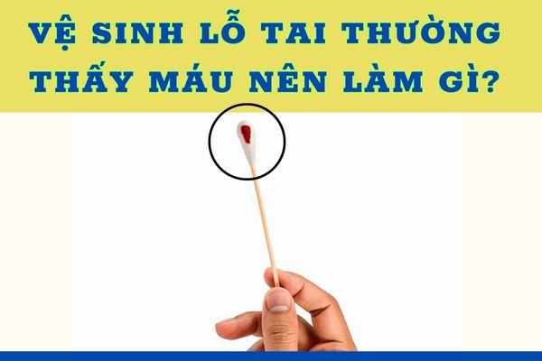 Vệ sinh thấy lỗ xỏ khuyên ra máu phải làm sao?