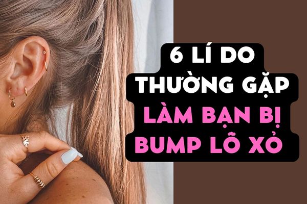 6 lí do thường gặp làm bạn bị bump lỗ xỏ