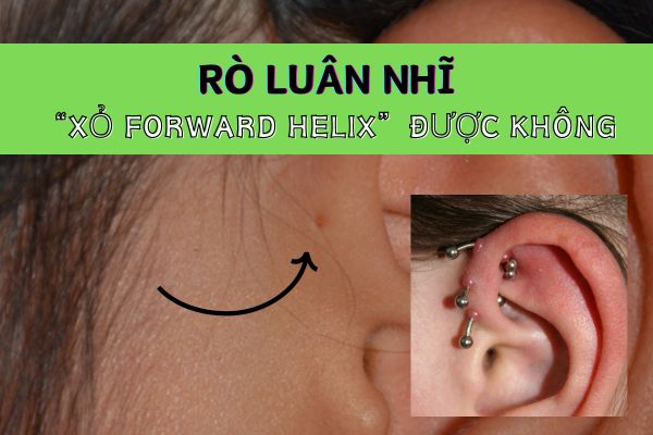 Xỏ forward helix nhưng tai bị rò luân nhĩ có nên thực hiện?