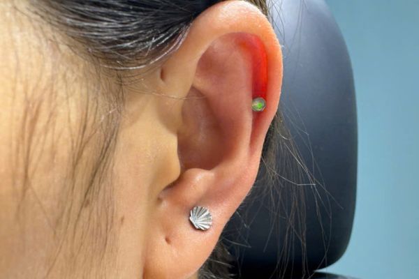 Xỏ Helix 1 năm tháo ra có bị mất lỗ không?