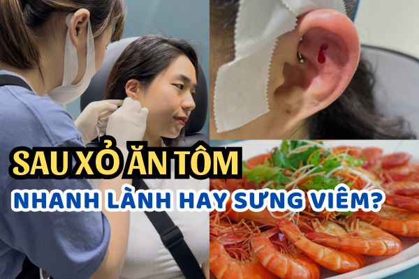 Xỏ khuyên ăn tôm được không?
