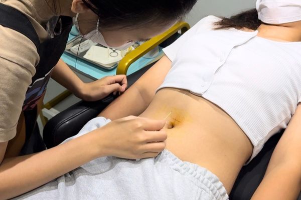 Xỏ khuyên chem chép  - xỏ khuyên lồn