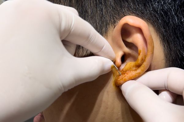 Xỏ khuyên có được uống thuốc giảm cân không