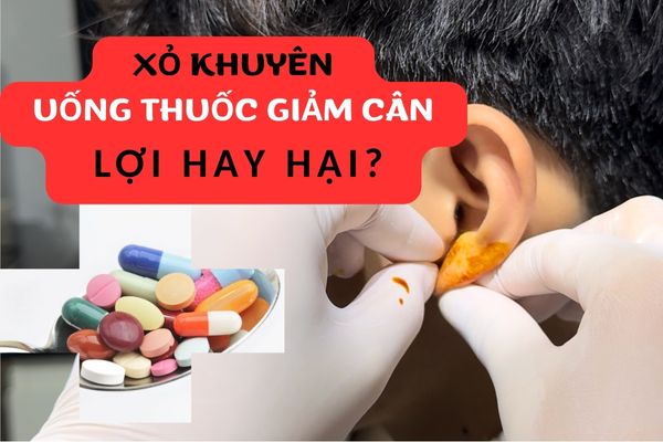 Xỏ khuyên có được uống thuốc giảm cân không