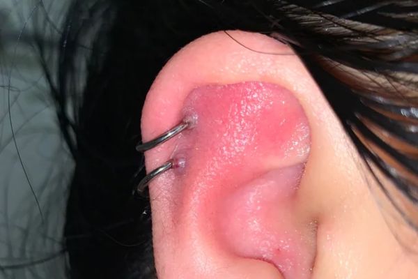 Xỏ khuyên có hại không? 