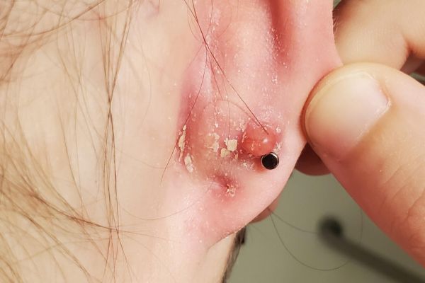 Xỏ khuyên có hại không? 