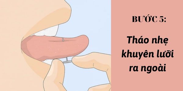 Xỏ khuyên lưỡi có tháo được không? 