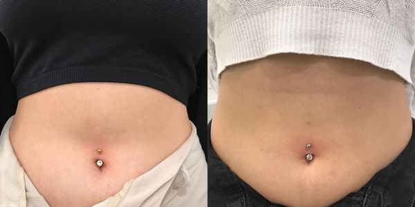 Xỏ khuyên rốn bị đào thải: Nguyên nhân và thời gian bạn có thể xỏ lại