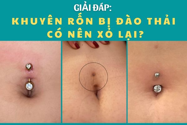 Xỏ khuyên rốn bị đào thải được xỏ lại không?